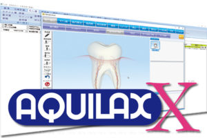 AQUILAX-Xの写真