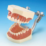 複製模型歯着脱顎模型[PE-ANA009]の写真