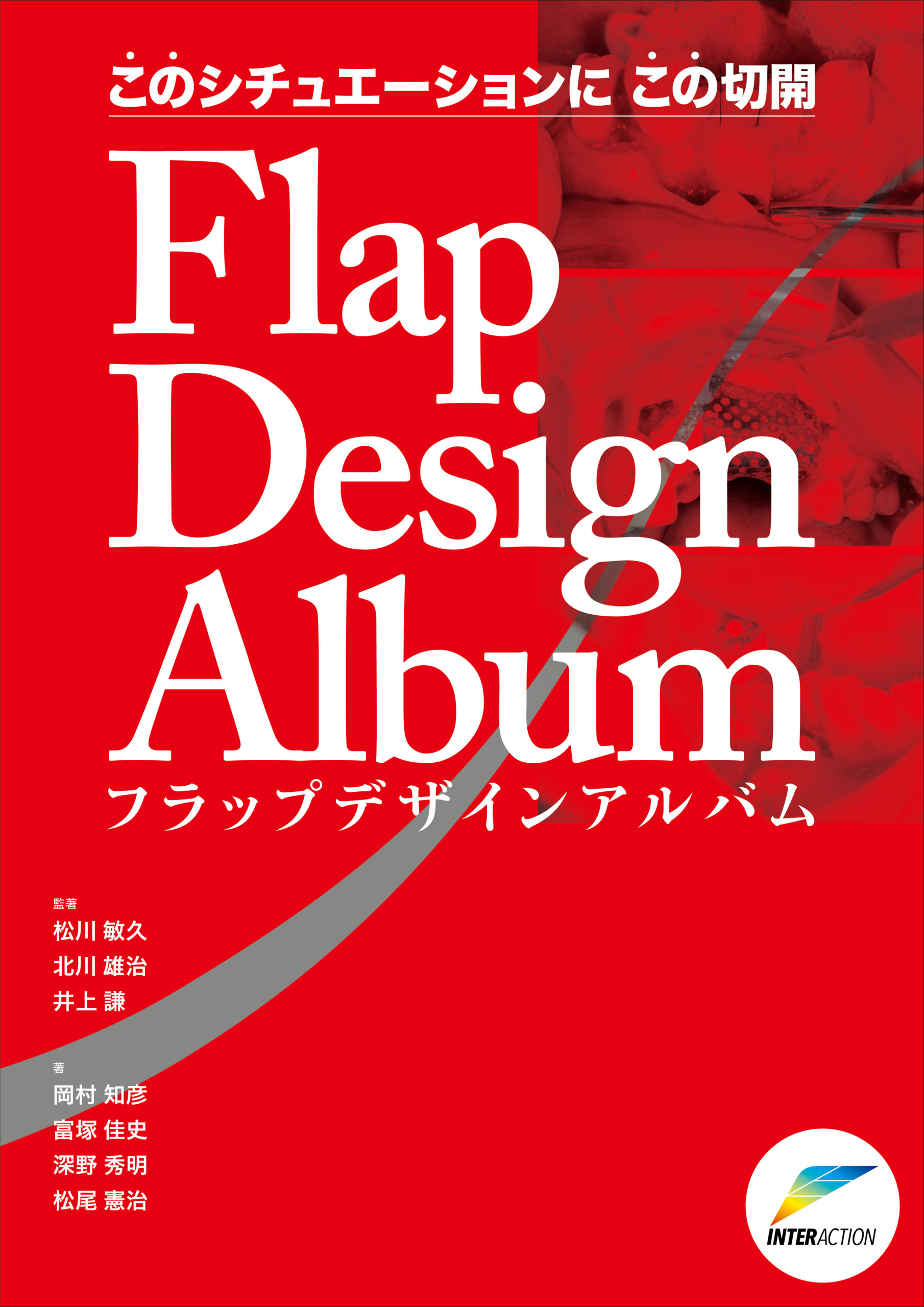 このシチュエーションにこの切開 Flap Design Album フラップデザインアルバムの写真