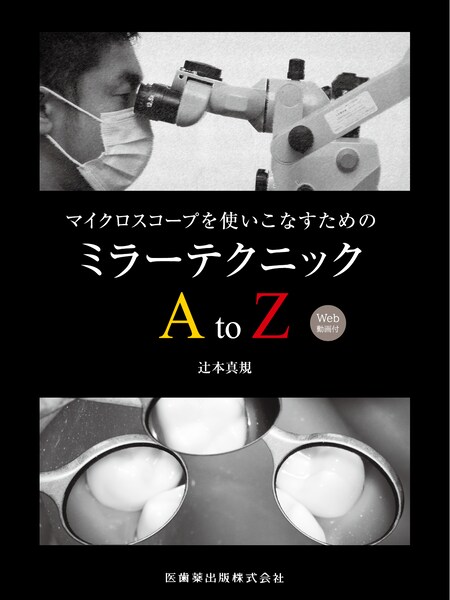 マイクロスコープを使いこなすための ミラーテクニックAtoZ Web動画付　辻本真規　著の写真