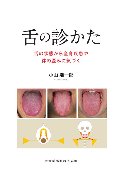 舌の診かた 舌の状態から全身疾患や体の歪みに気づく　小山浩一郎　著の写真