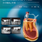 長期経過症例から紐解く根尖病変と骨縁下欠損の写真
