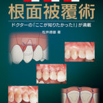 イラストレイテッド　安全・安心・確実　根面被覆術の写真