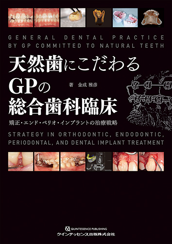 天然歯にこだわるGPの総合歯科臨床の写真
