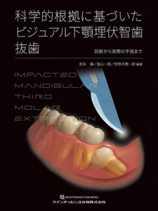 科学的根拠に基づいた ビジュアル下顎埋伏智歯抜歯の写真