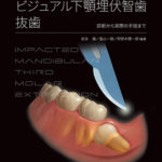 科学的根拠に基づいた ビジュアル下顎埋伏智歯抜歯の写真