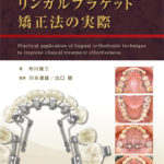 臨床的治療効果を引き出す　リンガルブラケット矯正法の実際の写真