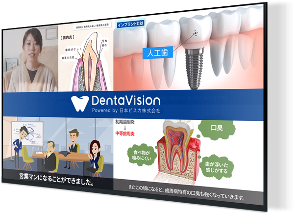 デジタルサイネージ【Denta Vision】の写真