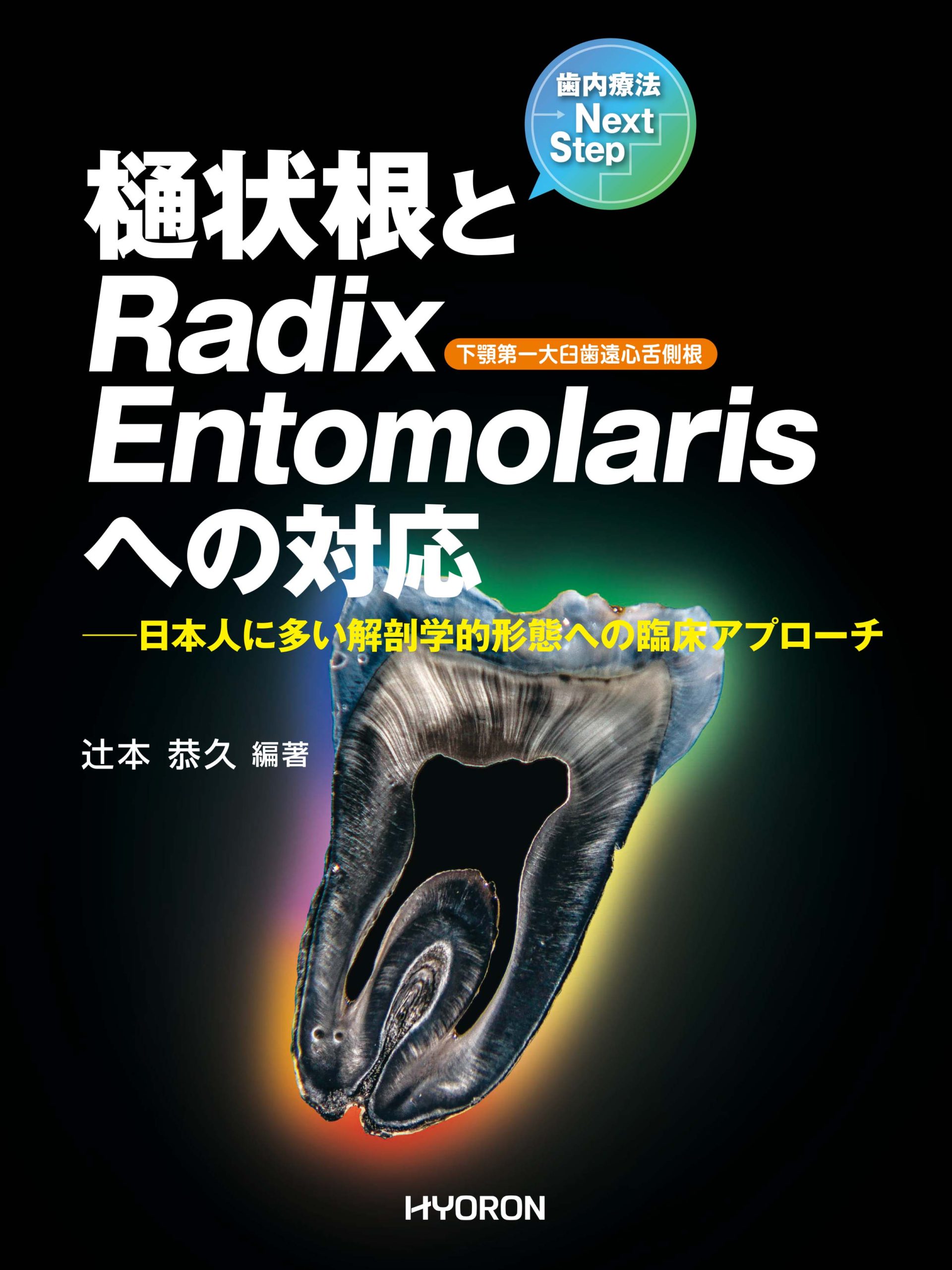 歯内療法Next Step　樋状根とRadix Entomolarisへの対応―日本人に多い解剖学的形態への臨床アプローチ（辻本恭久 編著）の写真