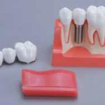 保護中: メガナビⅠの写真