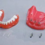 保護中: メガナビⅢの写真