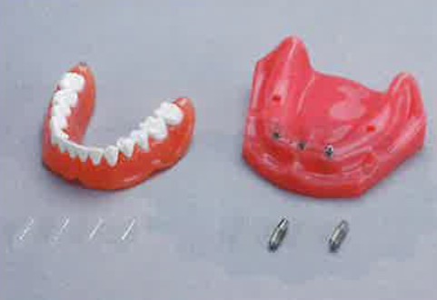 保護中: メガナビⅢの写真