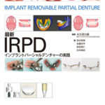 最新IRPD インプラントパーシャルデンチャーの実践の写真