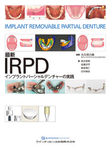 最新IRPD インプラントパーシャルデンチャーの実践の写真