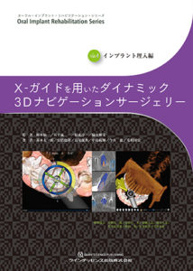 オーラル・インプラント・リハビリテーション・シリーズ Vol.4　インプラント埋入編 X-ガイドを用いたダイナミック3Dナビゲーションサージェリーの写真