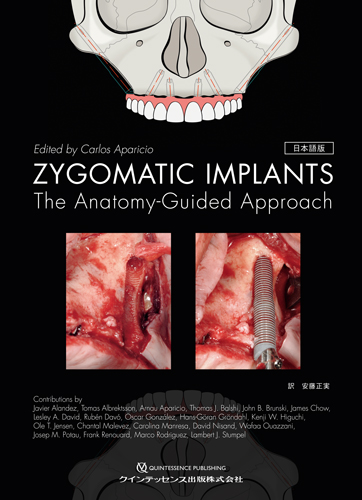 ZYGOMATIC IMPLANTS　日本語版の写真