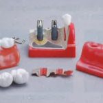 保護中: メガナビⅡSの写真