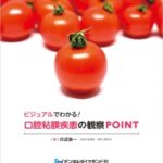 ビジュアルでわかる！口腔粘膜疾患の観察POINTの写真