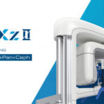 アーム型X線CT診断装置 ソリオ エックスシリーズ　SOLIO XZII MAXIMの写真
