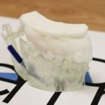 【歯科用AR/3D模型作成サービス】DenPre 3D Labの写真