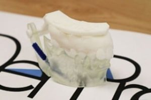 【歯科用AR/3D模型作成サービス】DenPre 3D Labの写真