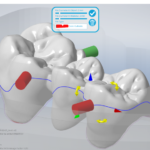 加工ソフト　Millboxの写真