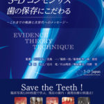 5-Dコンセンサス　歯の保存にこだわるの写真