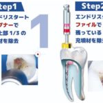 コメット　エンドリスタートの写真