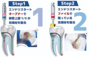 コメット　エンドリスタートの写真