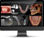 DTX Studio™ Clinicの写真