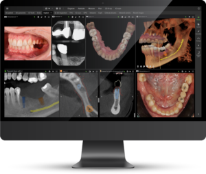 DTX Studio™ Clinicの写真