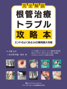 完全解説　根管治療トラブル攻略本の写真