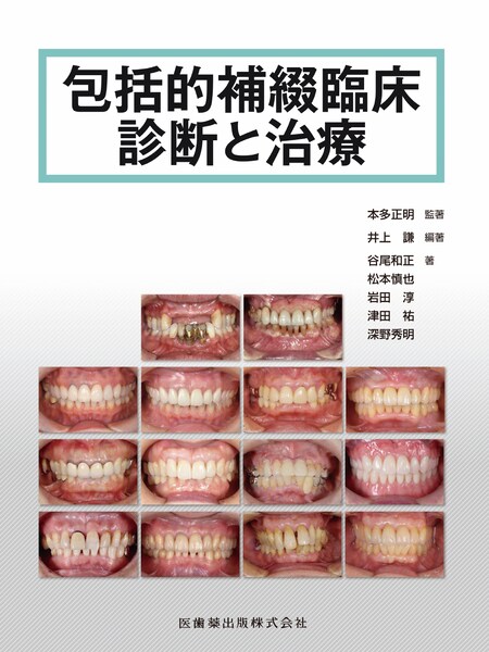 包括的補綴臨床診断と治療　本多正明　監修／井上謙　編著／谷尾和正・松本慎也　著の写真