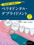 “超音波”を攻略せよ ペリオドンタル・デブライドメント プラス1　大野純一　編著／光家由紀子・加藤雄大・倉治竜太郎　著の写真