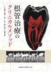 根管治療のクリニカルメソッド　長谷川智哉・木方一貴・宮本侑果・伊藤友見　著の写真