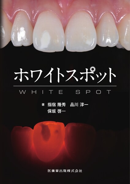 ホワイトスポット　指宿隆秀・品川淳一・保坂啓一　著の写真