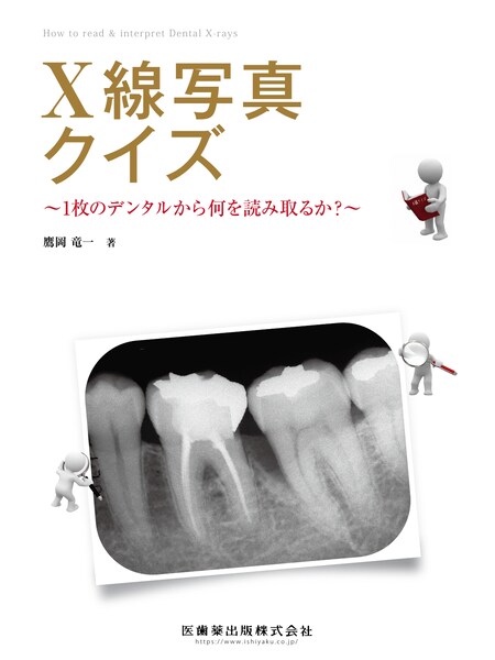 X線写真クイズ 1枚のデンタルから何を読み取るか？　鷹岡竜一　著の写真