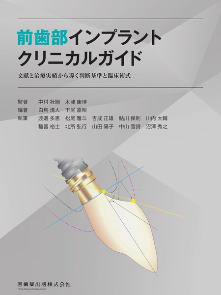 前歯部インプラントクリニカルガイド 文献と治療実績から導く判断基準と臨床術式　中村社綱・木津康博　監著／白鳥清人・下尾嘉昭　編著の写真